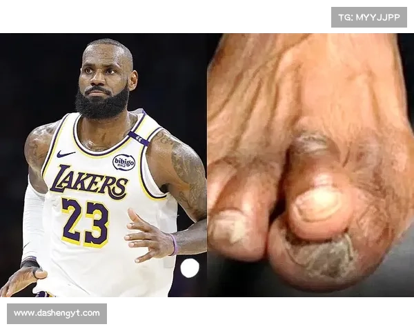 NBA上赛季9大最脏球员:乐福手臂被撕断 詹姆斯被踢下体 NBA上赛季9大最脏球员:乐福手臂被撕断 詹姆斯被踢下体